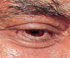 Window to Soul