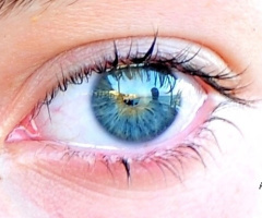 sometimes eyes like a mirrow 