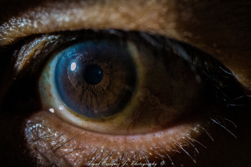My Macro Eye