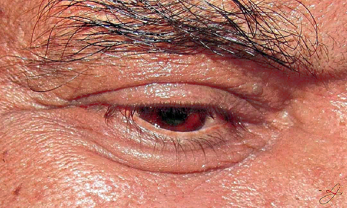 Window to Soul