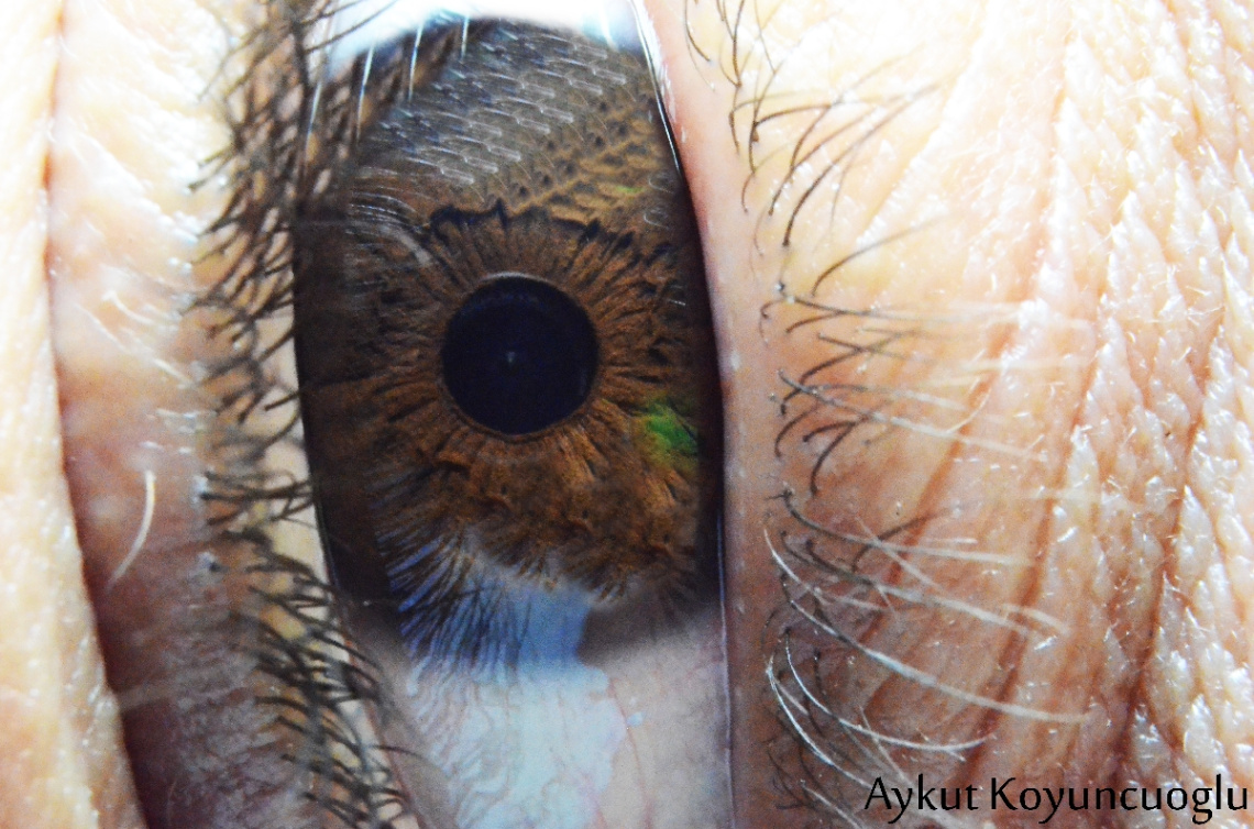 Gözün göremediği şeylerr..